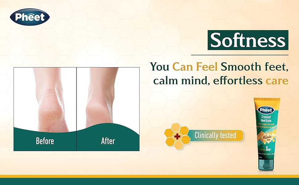 cracked heel repair cream