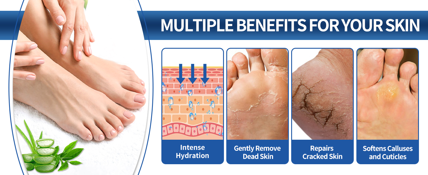 foot cream for dry cracked heels and feet