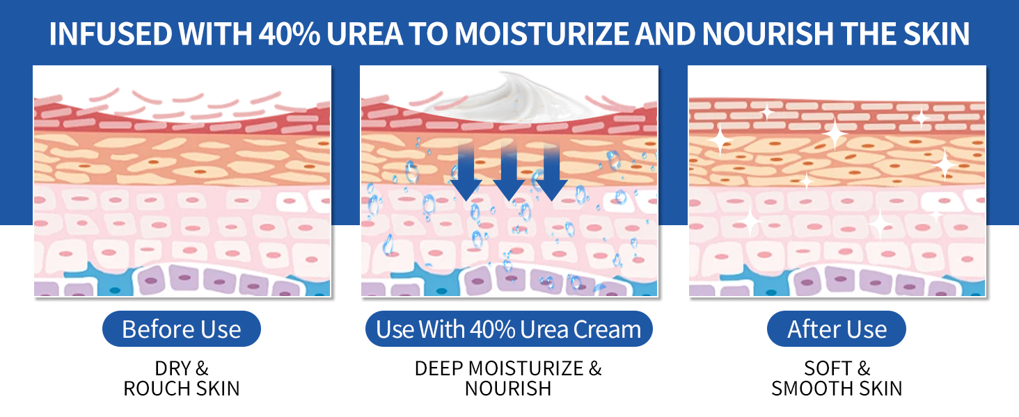 foot lotion for dry cracked feet