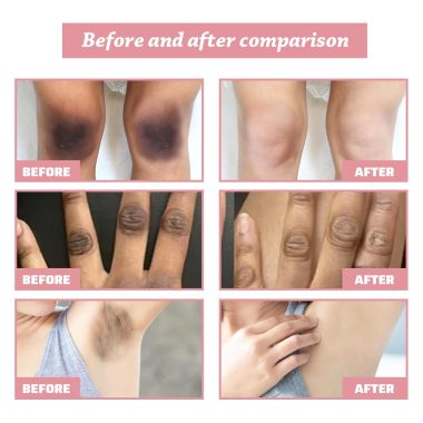 2Pcs 50ml Dark Spot Repair Cream for Women, Intimate Brightening for Face, Underarms, Neck, Private Areas