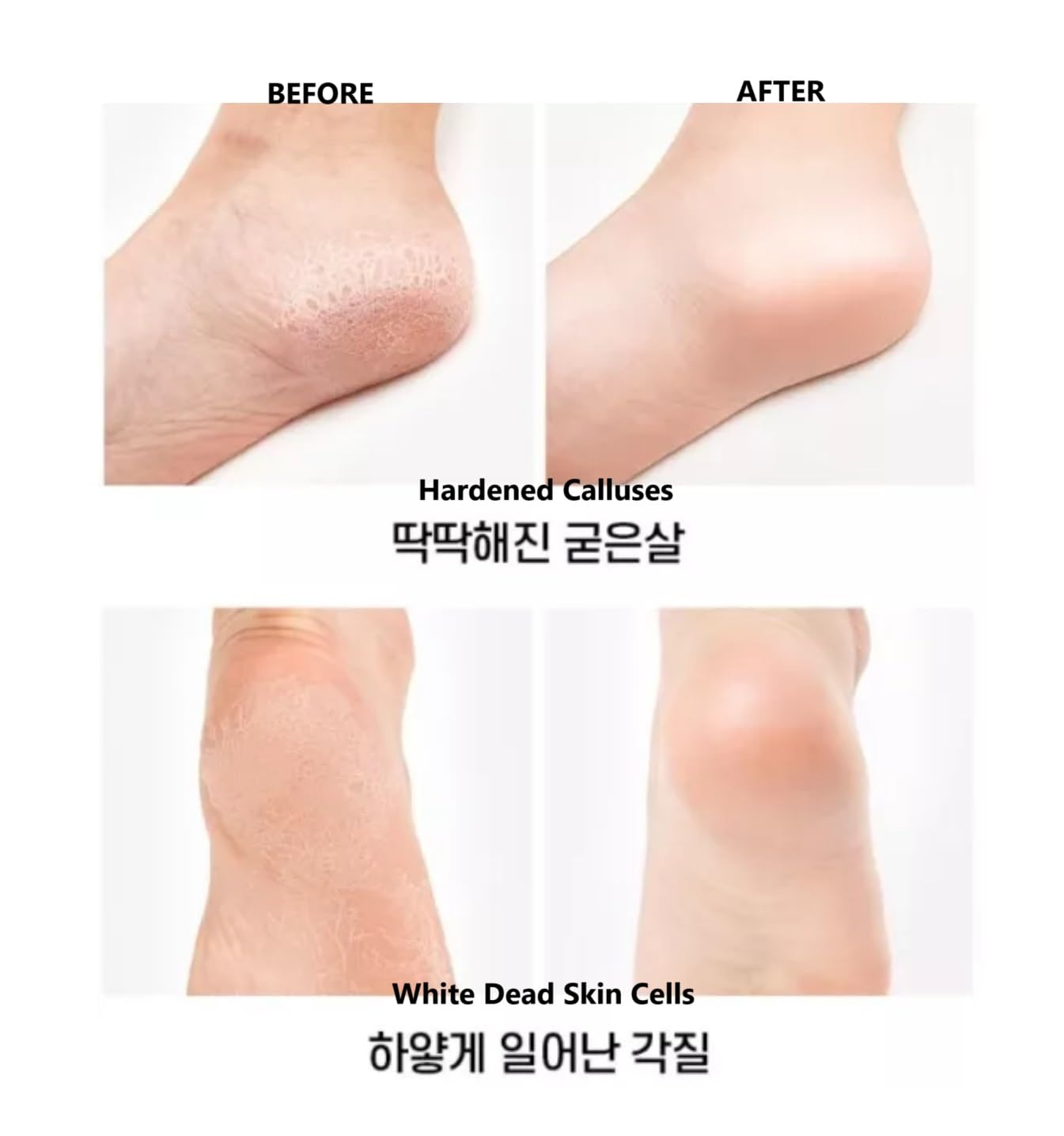UBuy Korea Foot Care Cream 60g Deeply Moisturizing for Dry Feet and Cracked Heels - Image 6