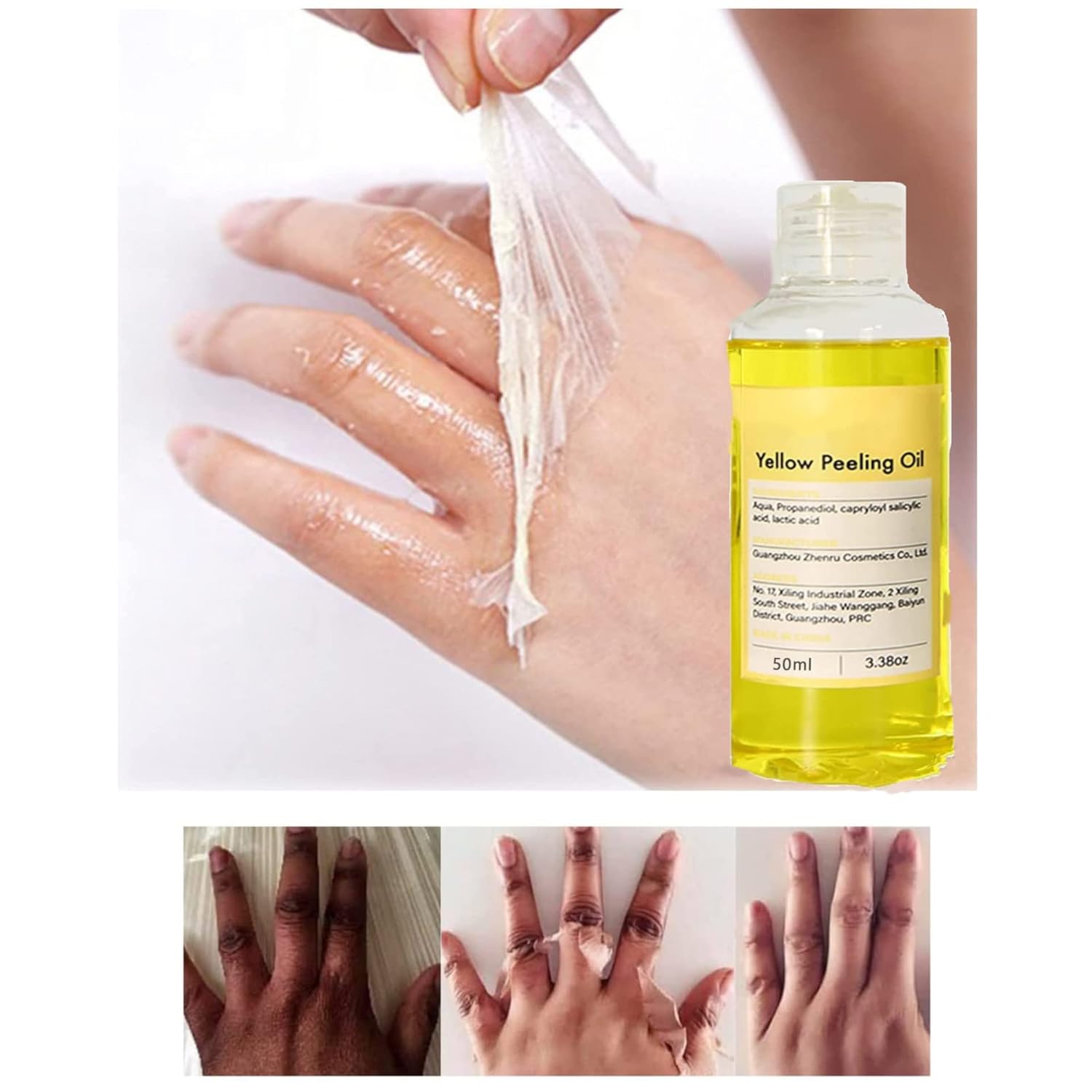 Extra Strength 50ml Yellow Peeling Oil for Dark Skin, All Skin Types