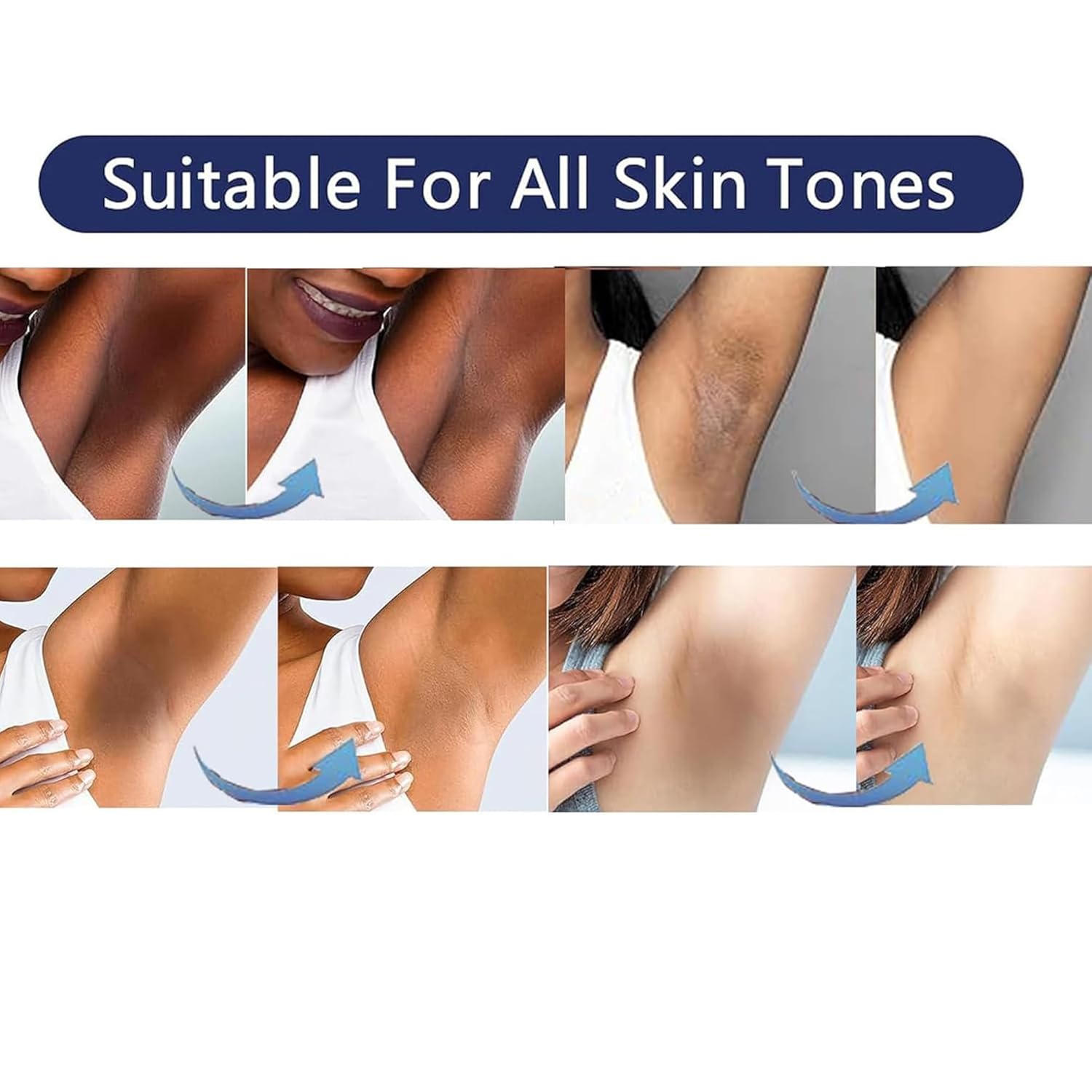 **GlowBright Intimate Skin Lightening Cream 30ml for Private Areas and Body** - Image 3